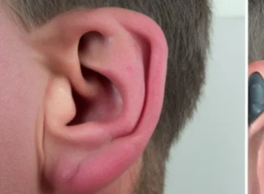 Jak samemu przepłukać ucho